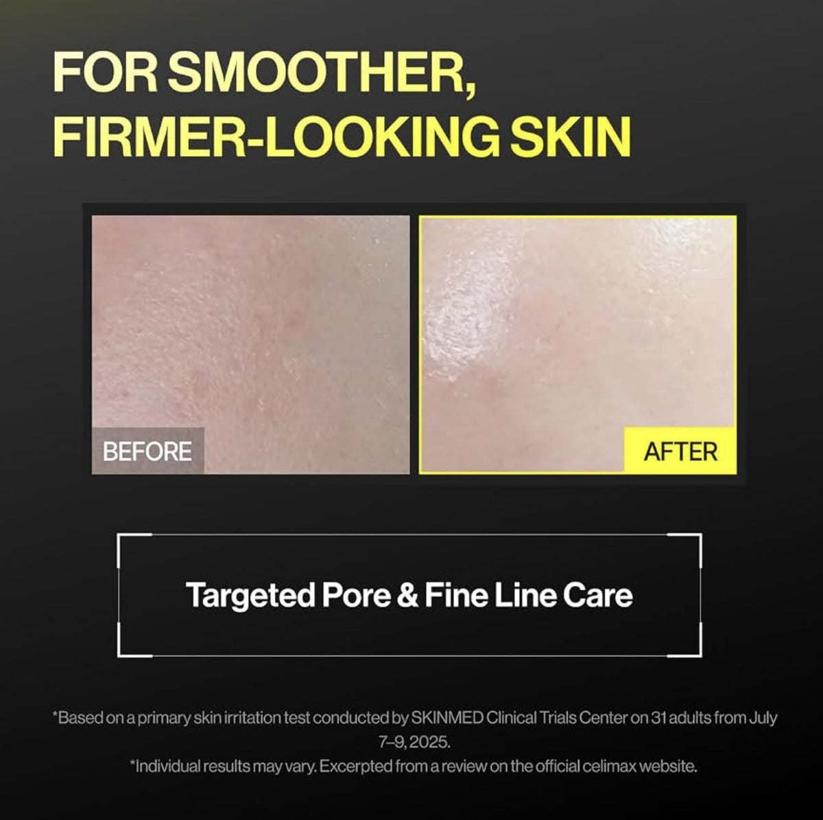 Avant / après Retinal Shot Booster